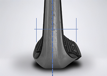 Offset center of gravity